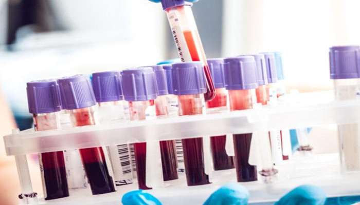 预防癌症有望 微软将通过血液测试建立早期预警系统