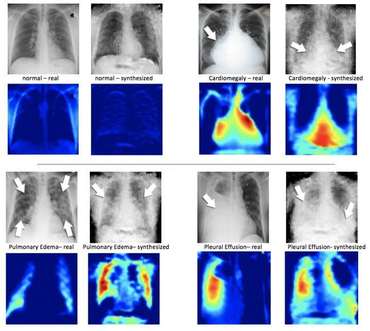AI结合人工X射线准确识别医学图像中的罕见情况