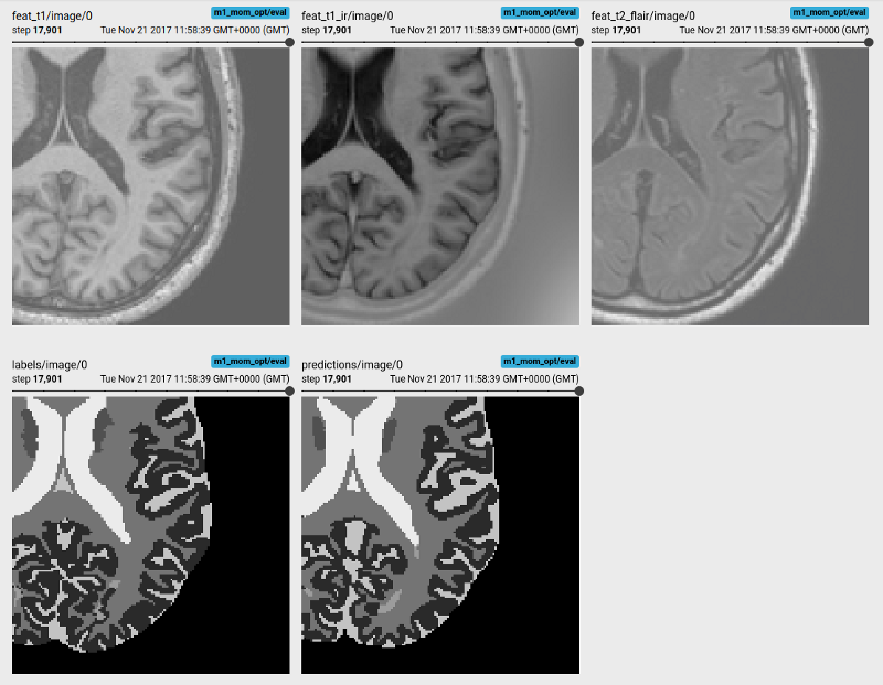 使用TensorFlow和DLTK进行生物医学图像分析的介绍