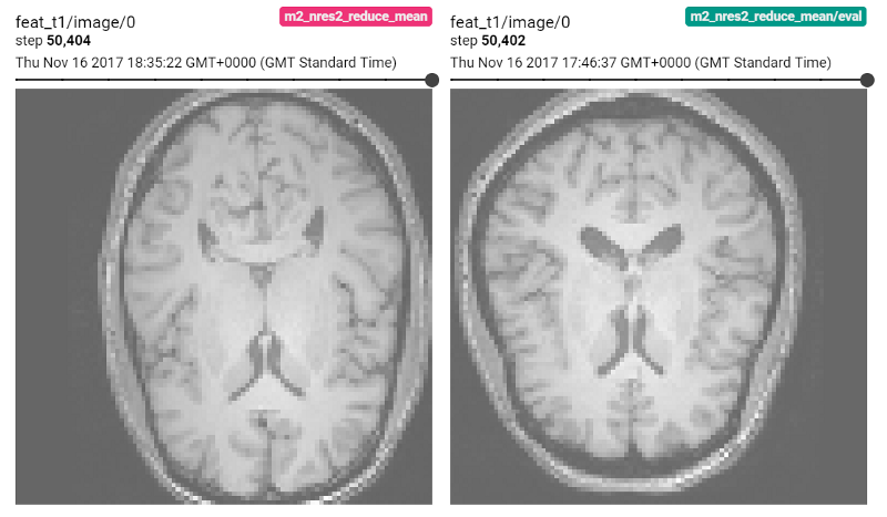 使用TensorFlow和DLTK进行生物医学图像分析的介绍